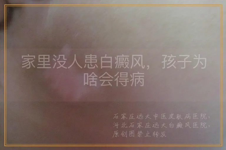 家里没人患白癜风，孩子为啥会得病