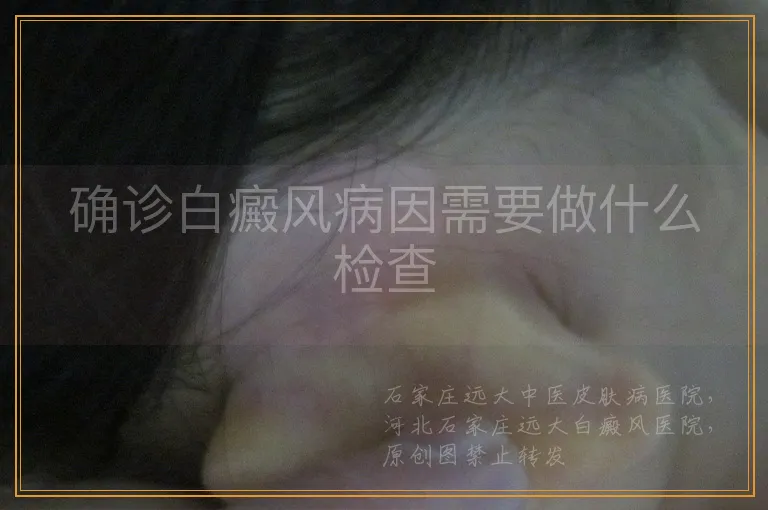 确诊白癜风病因需要做什么检查