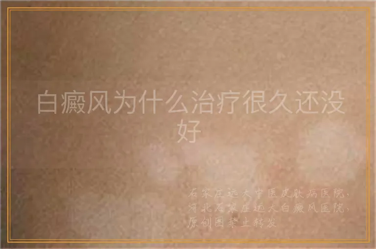 白癜风为什么治疗很久还没好
