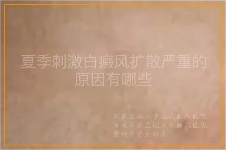 夏季刺激白癜风扩散严重的原因有哪些