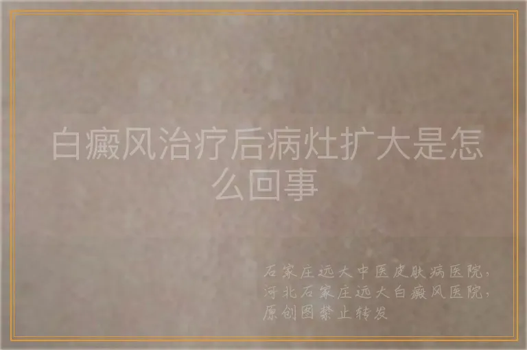 白癜风治疗后病灶扩大是怎么回事