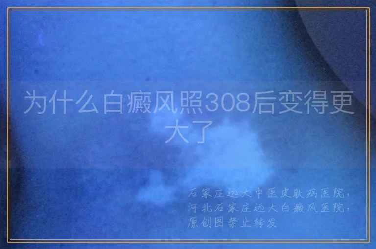 为什么白癜风照308后变得更大了