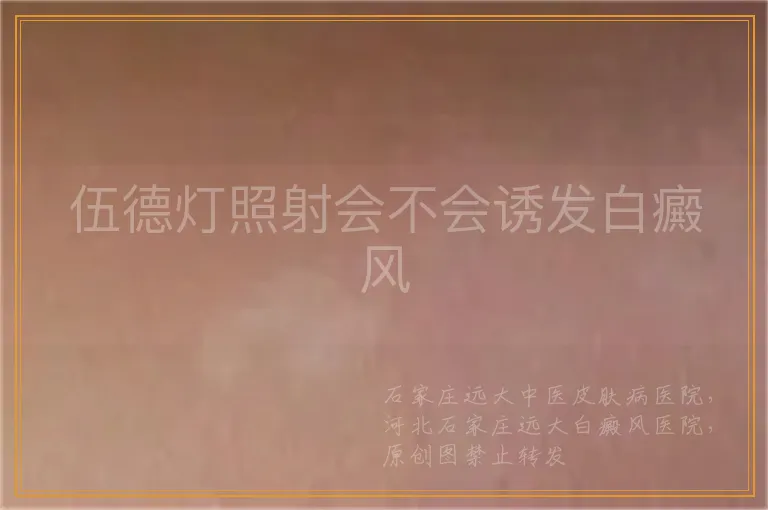 伍德灯照射会不会诱发白癜风