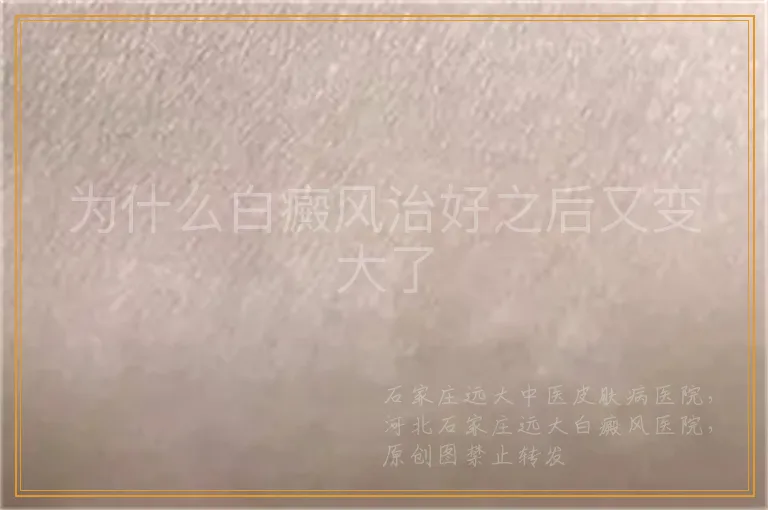 为什么白癜风治好之后又变大了