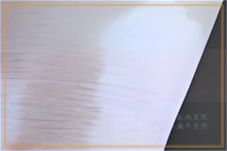 肚子上有白斑白点怎么确定是不是白癜风