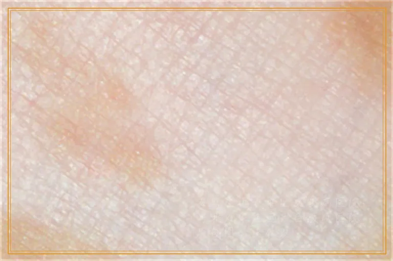 孩子脸上有一片白是什么病做什么检查