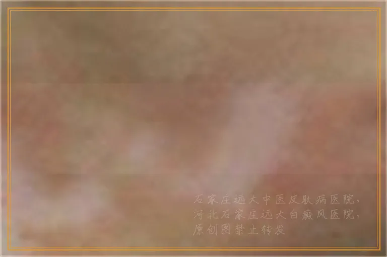 手上有白点用肉眼可以判断吗