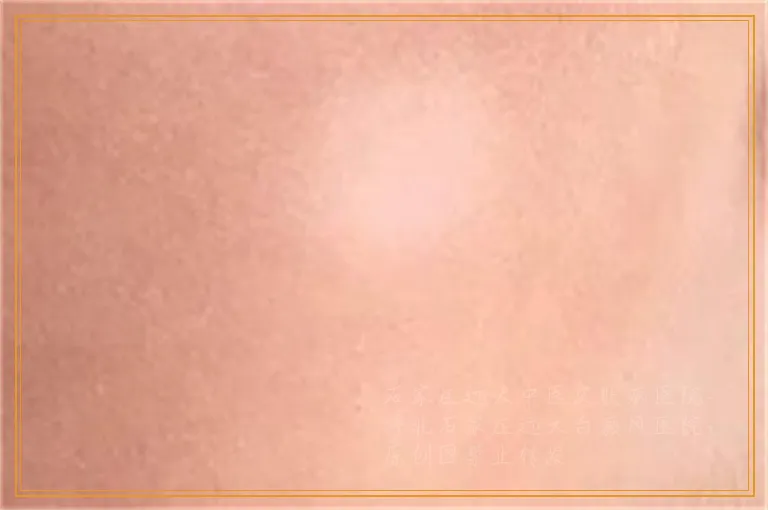 wood灯下白癜风的症状表现