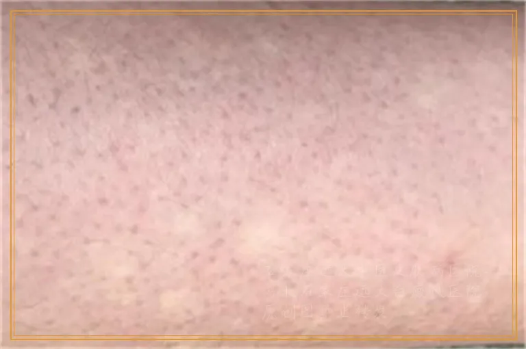 大腿上有几个白点是不是白癜风