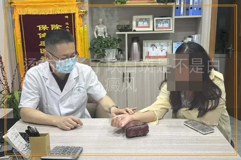 烫伤处长了块白斑是不是白癜风