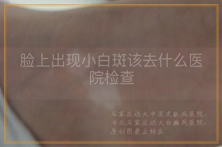 脸上出现小白斑该去什么医院检查