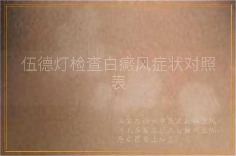 伍德灯检查白癜风症状对照表