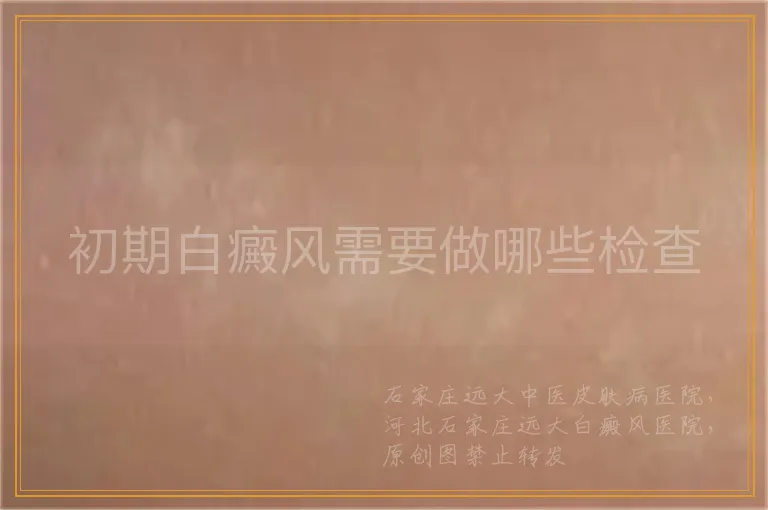 初期白癜风需要做哪些检查