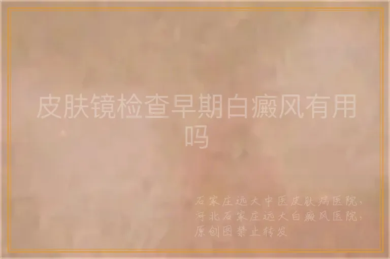 皮肤镜检查早期白癜风有用吗