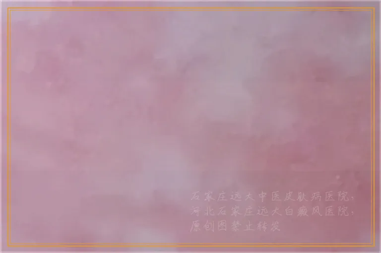 孩子腿上胳膊上长白斑怎么治疗好