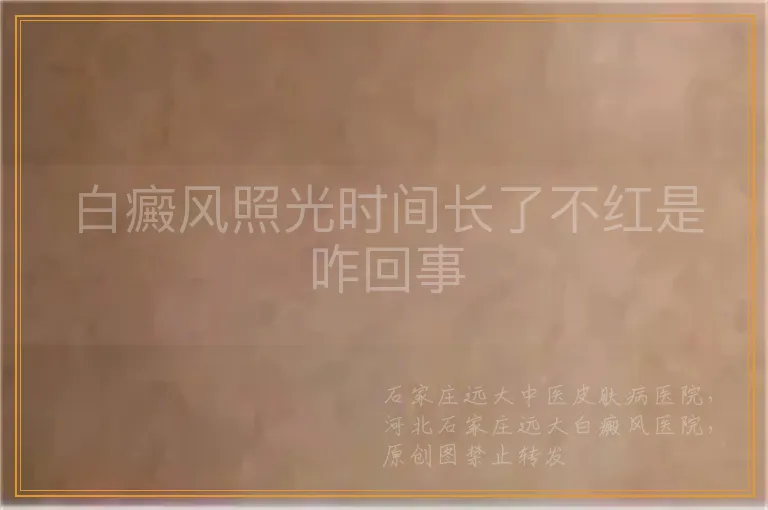 白癜风照光时间长了不红是咋回事