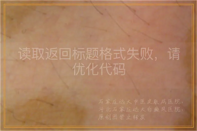 读取返回标题格式失败，请优化代码