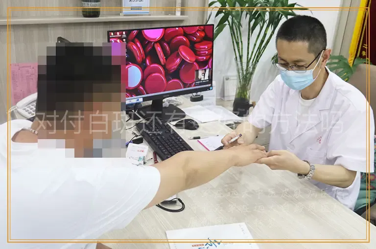 对付白斑还有更好的方法吗