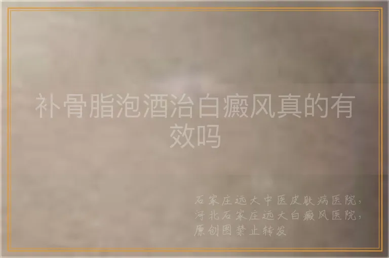 补骨脂泡酒治白癜风真的有效吗