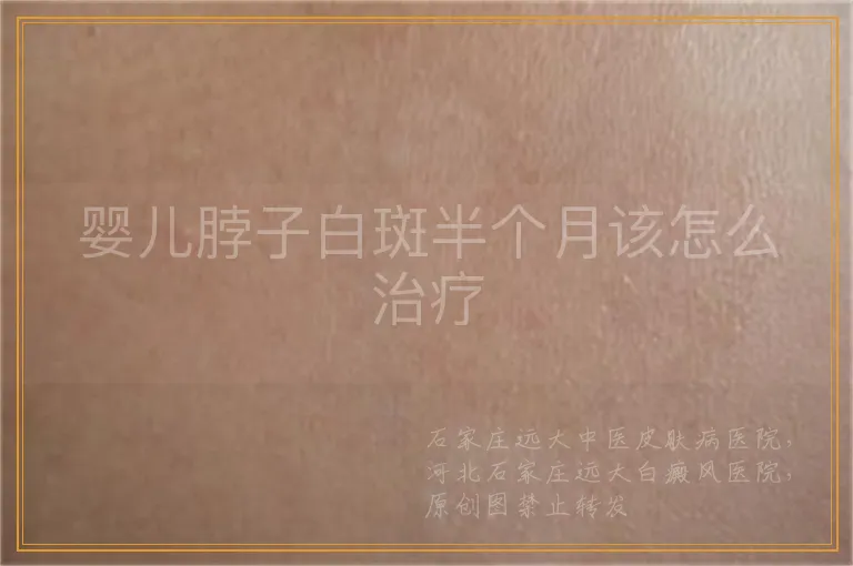 婴儿脖子白斑半个月该怎么治疗