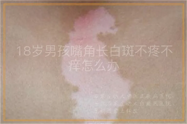 18岁男孩嘴角长白斑不疼不痒怎么办