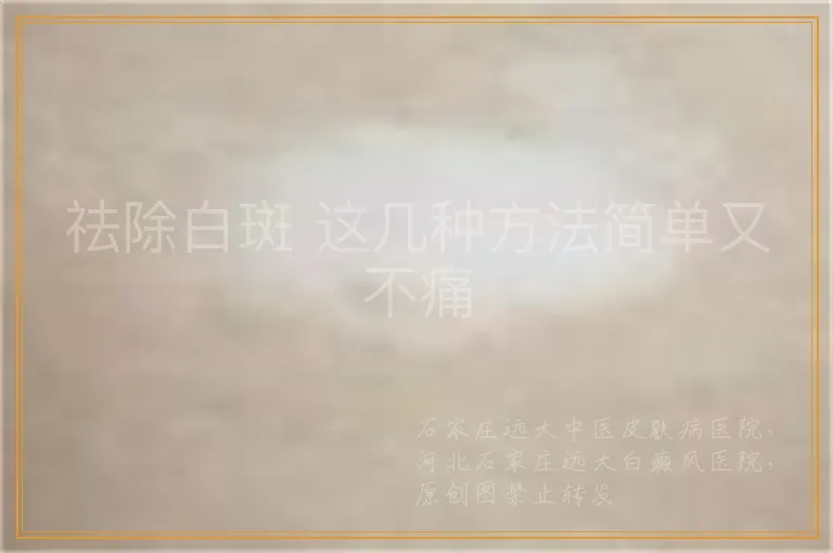 祛除白斑 这几种方法简单又不痛