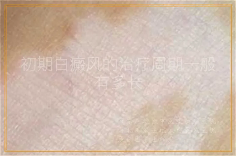 初期白癜风的治疗周期一般有多长