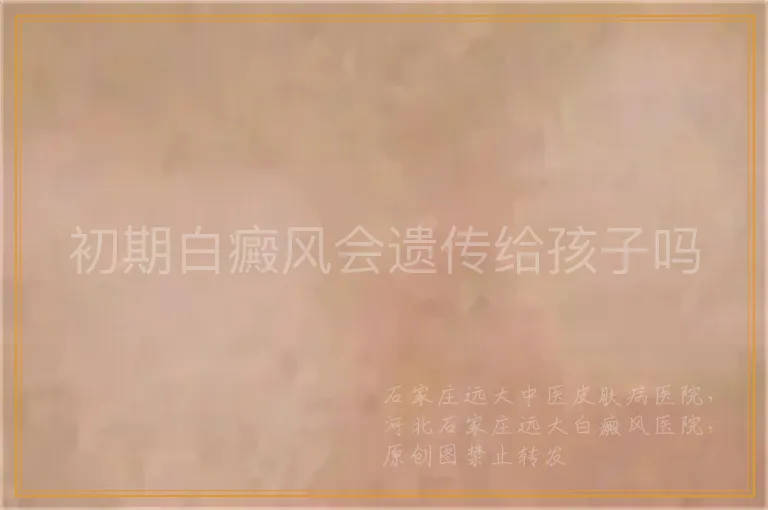 初期白癜风会遗传给孩子吗