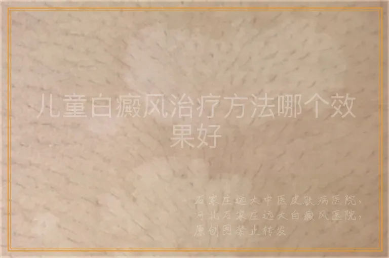 儿童白癜风治疗方法哪个效果好