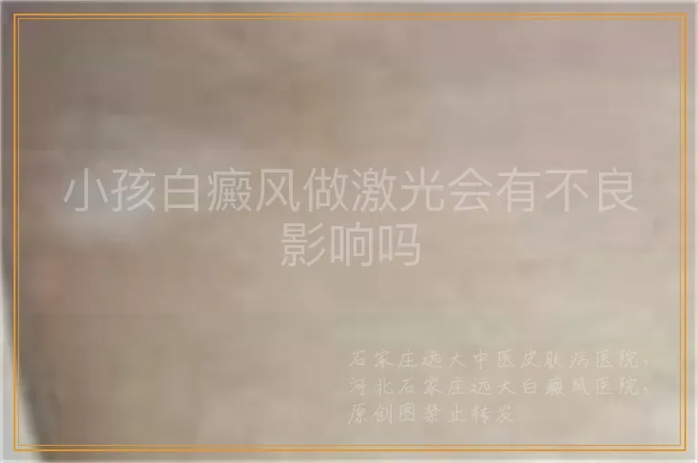 小孩白癜风做激光会有不良影响吗