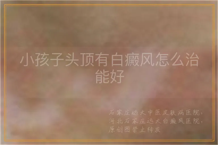 小孩子头顶有白癜风怎么治能好