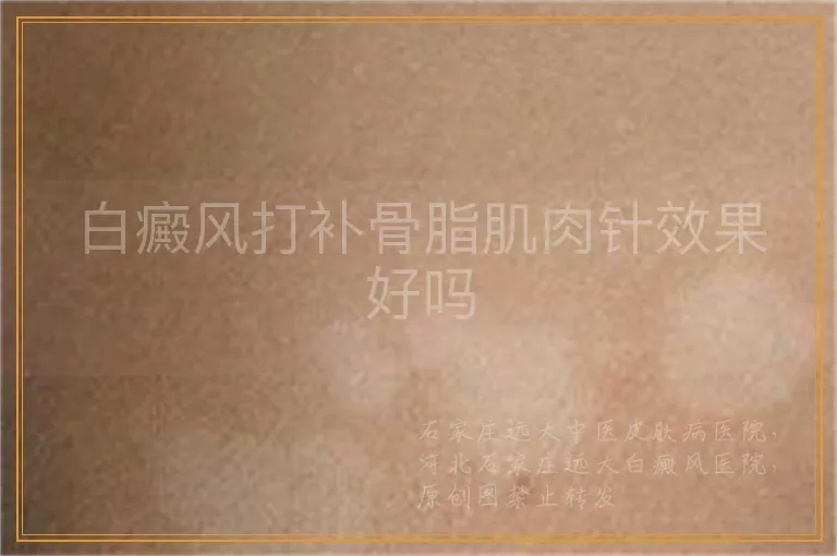 白癜风打补骨脂肌肉针效果好吗