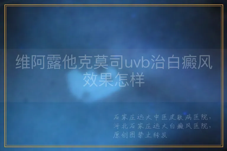 维阿露他克莫司uvb治白癜风效果怎样