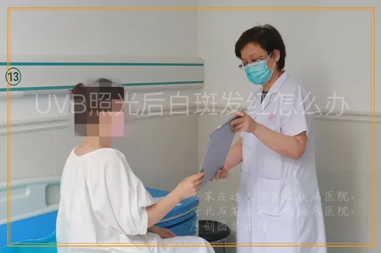 UVB照光后白斑发红怎么办
