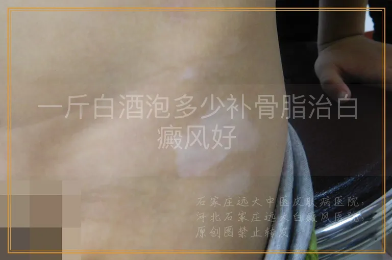 一斤白酒泡多少补骨脂治白癜风好