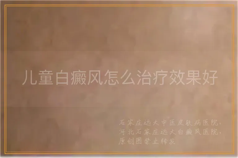 儿童白癜风怎么治疗效果好