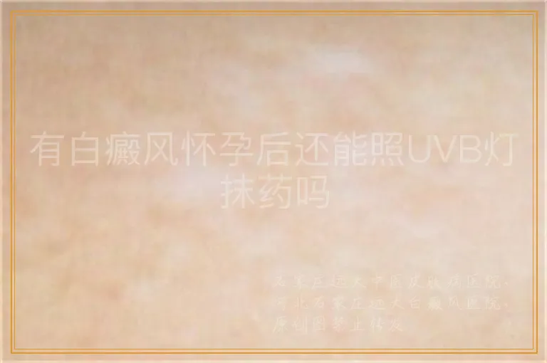 有白癜风怀孕后还能照UVB灯抹药吗