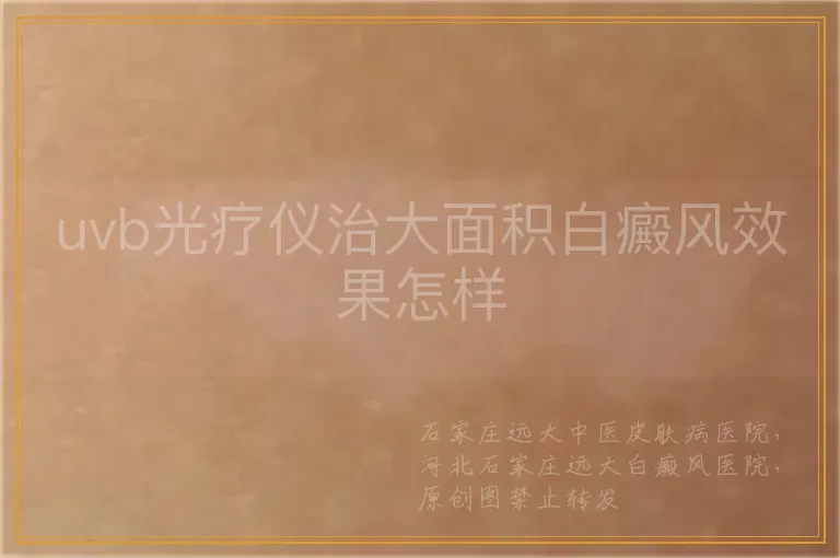 uvb光疗仪治大面积白癜风效果怎样