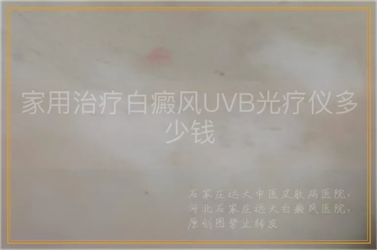家用治疗白癜风UVB光疗仪多少钱