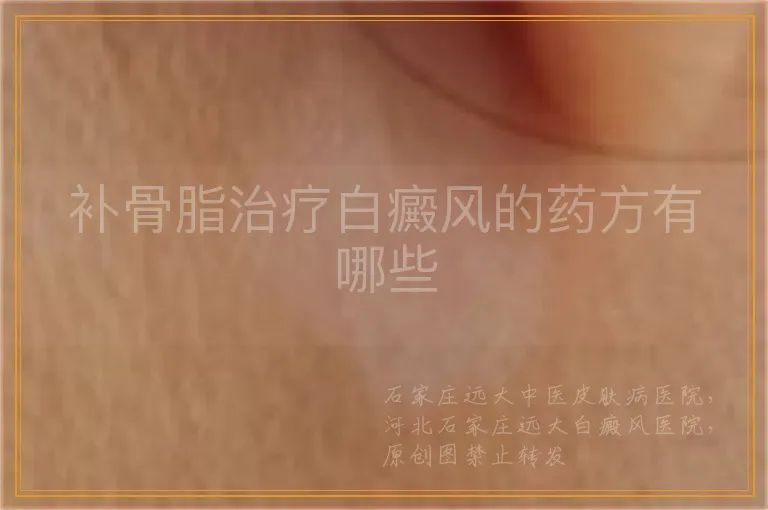 补骨脂治疗白癜风的药方有哪些