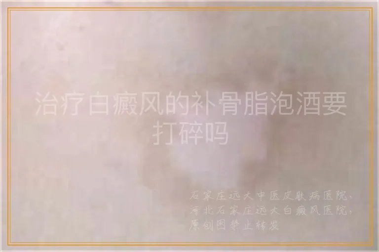 治疗白癜风的补骨脂泡酒要打碎吗