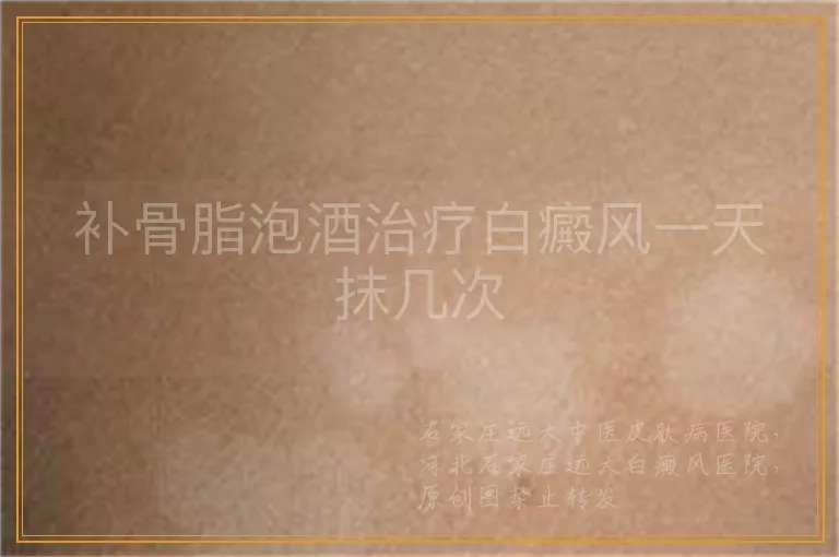 补骨脂泡酒治疗白癜风一天抹几次