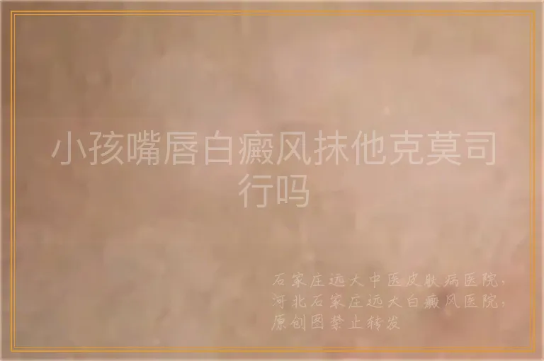 小孩嘴唇白癜风抹他克莫司行吗