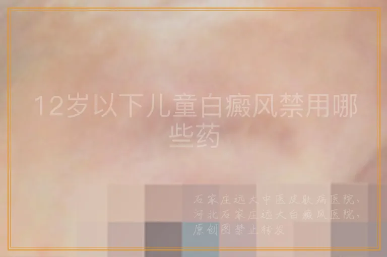 12岁以下儿童白癜风禁用哪些药