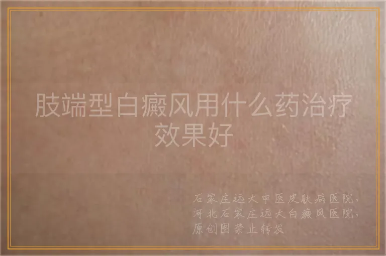 肢端型白癜风用什么药治疗效果好
