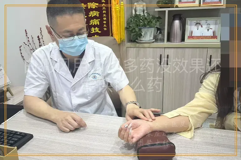白癜风用了很多药没效果还能换什么药