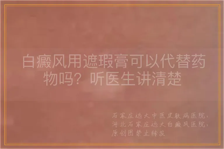 白癜风用遮瑕膏可以代替药物吗？听医生讲清楚
